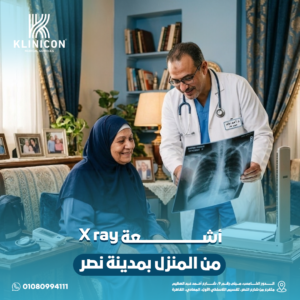 أشعة X ray من المنزل بمدينة نصر